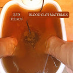 Recover X - Ionic Foot Spa | Elimina toxinas y metales pesados para una vida más saludable