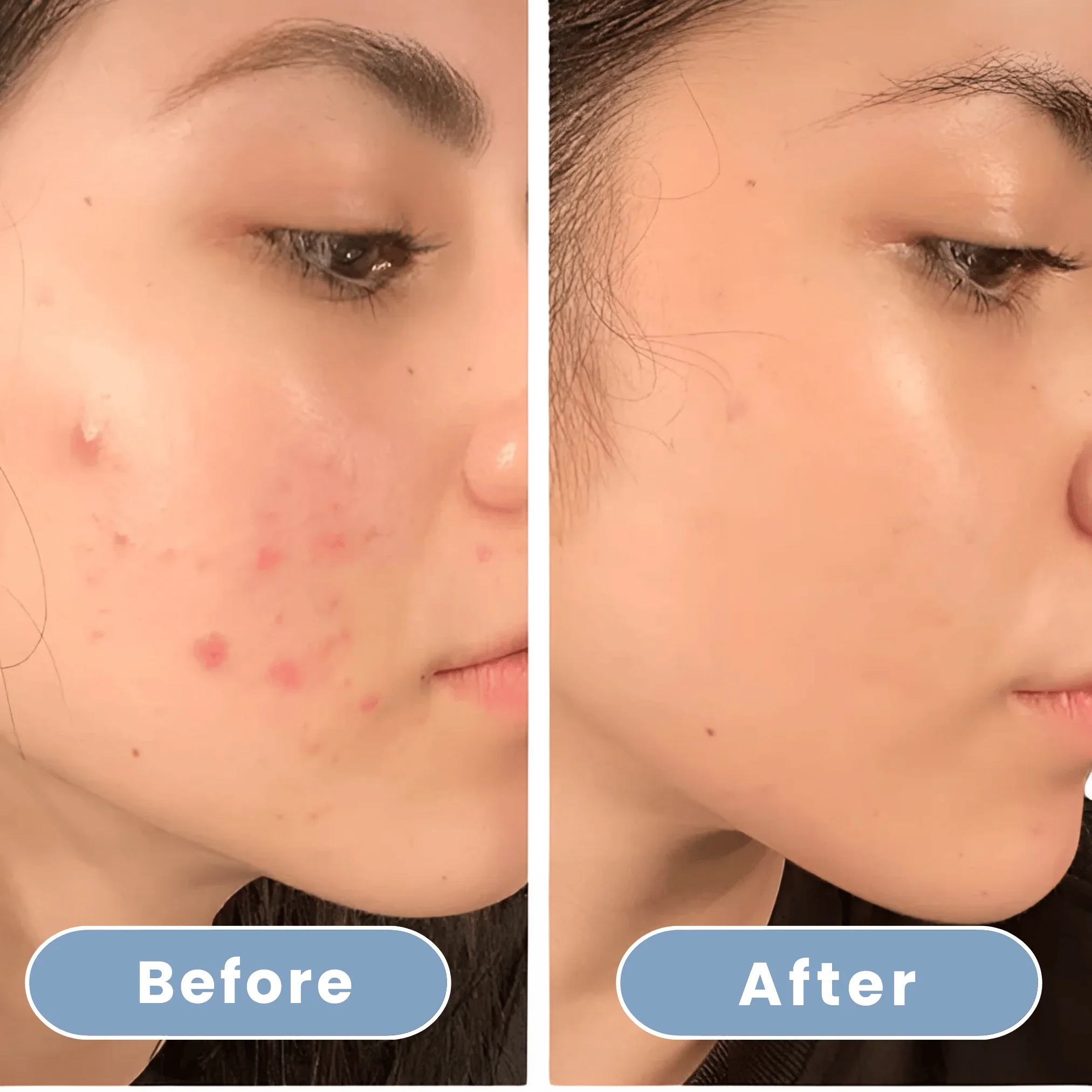 Aqualuce PureFlow – Lujosa Alcachofa de Ducha con Función de Masaje y Filtros