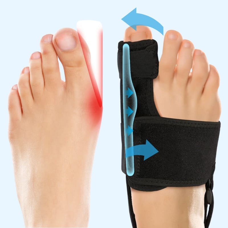 Valgux™ Soporte | Corrector para juanetes (Hallux Valgus)