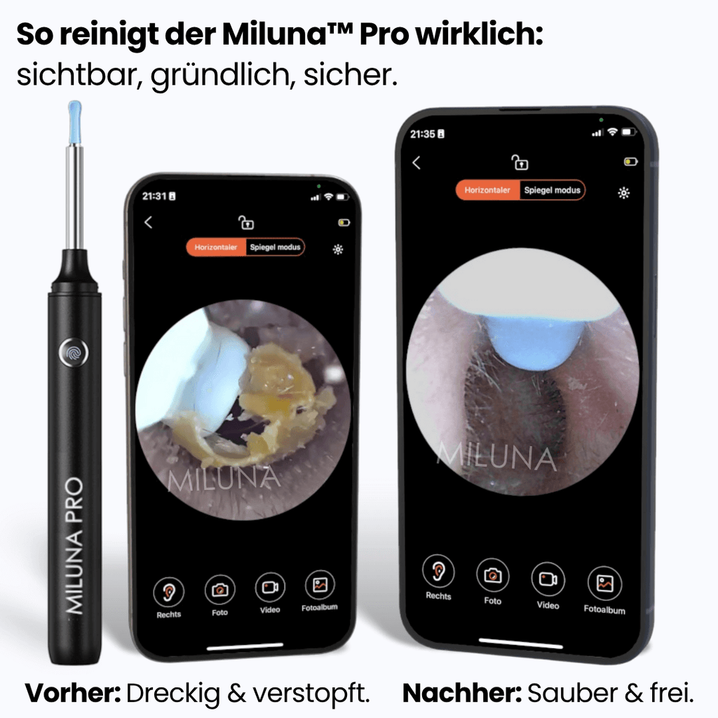 Miluna™ Pro
