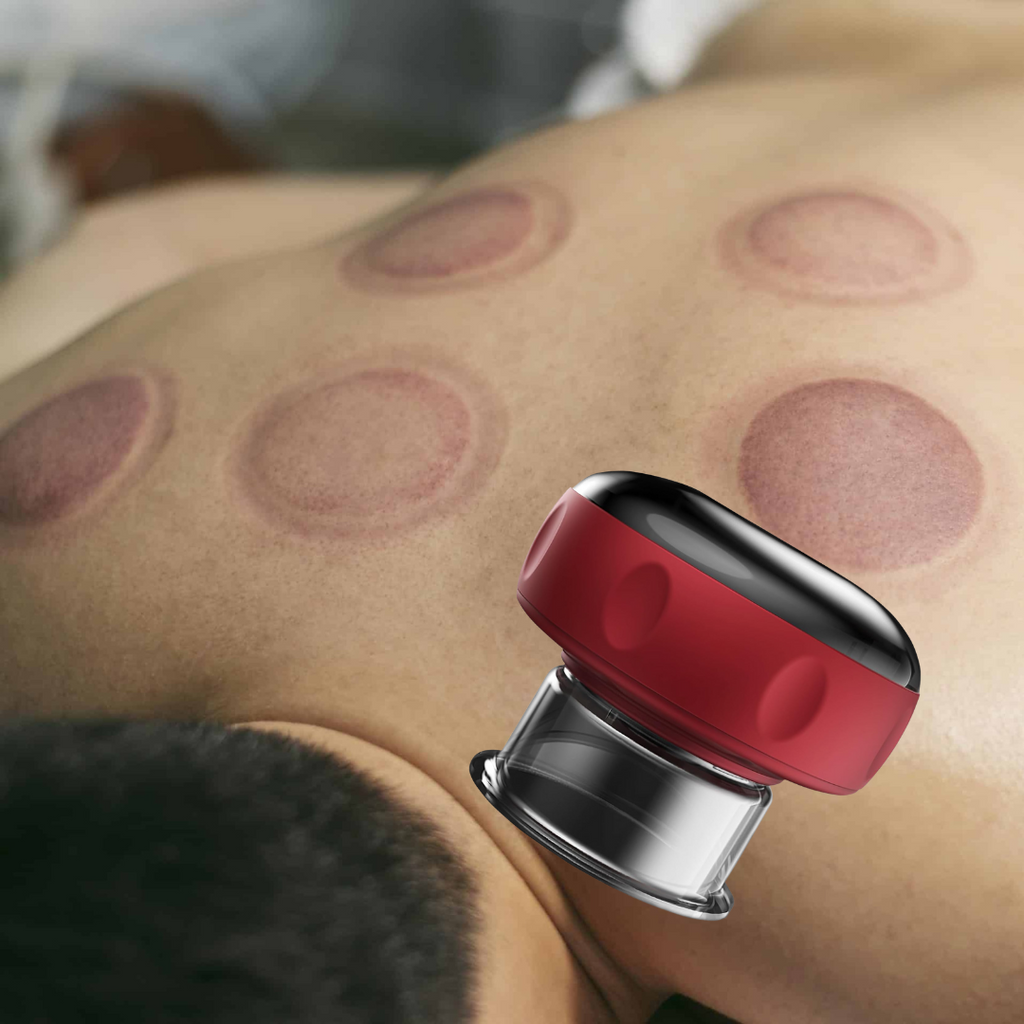 RecoverX™ – Elektrische Cupping Cup | Spierherstel & Pijnverlichting na Training