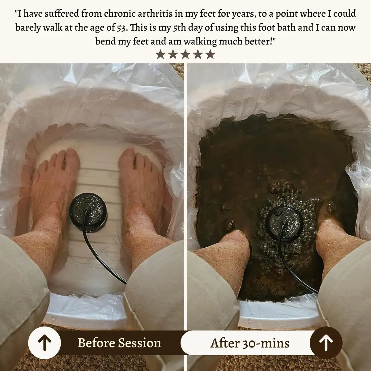 Recover X - Ionic Foot Spa | Elimina toxinas y metales pesados para una vida más saludable